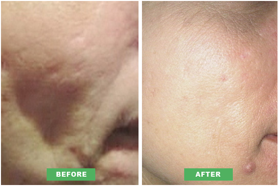  Perfect Skin – Beauty and Skincare treatments in Essex and London