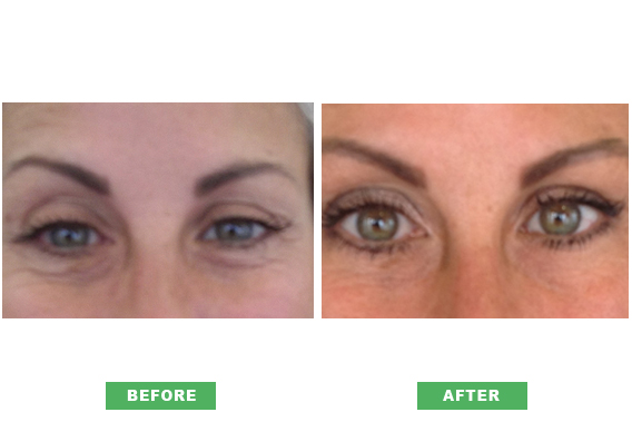  Perfect Skin – Beauty and Skincare treatments in Essex and London